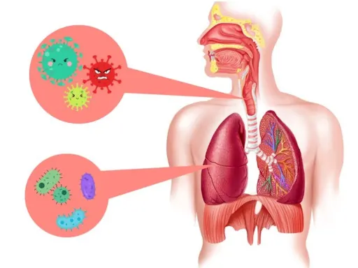 Virus là nguyên nhân chính yếu gây nên bệnh viêm phế quản cấp